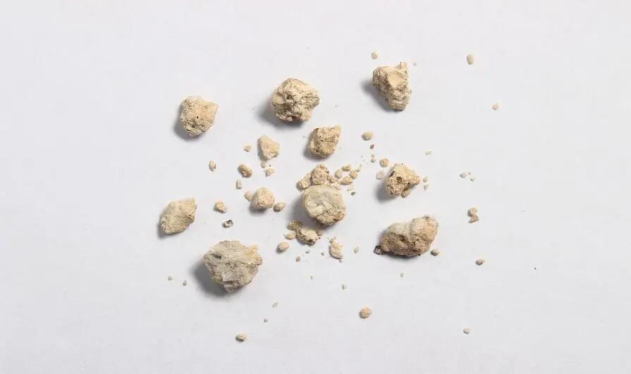 4.5毫米的结石一直掉不下来,4公分结石有多大