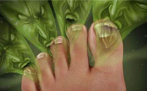 日本人如何处理脚气问题,欧美人为什么更容易患脚气