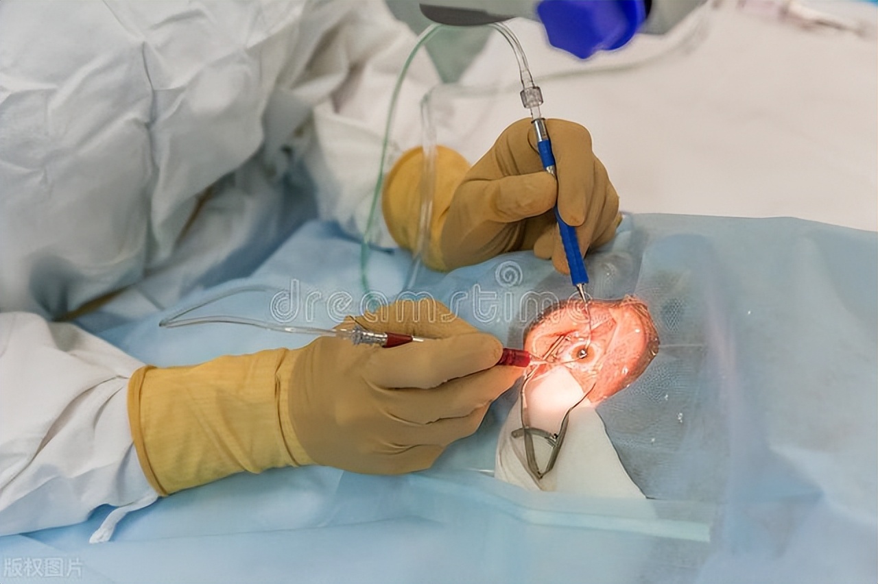 老年性白内障用什么眼药水,老年性白内障可以喝牛奶吗