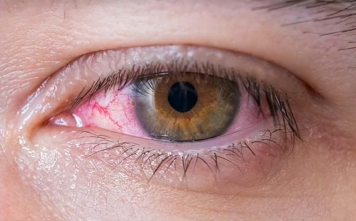 远离电子产品保护眼睛,成年人常用电子产品如何保护眼睛