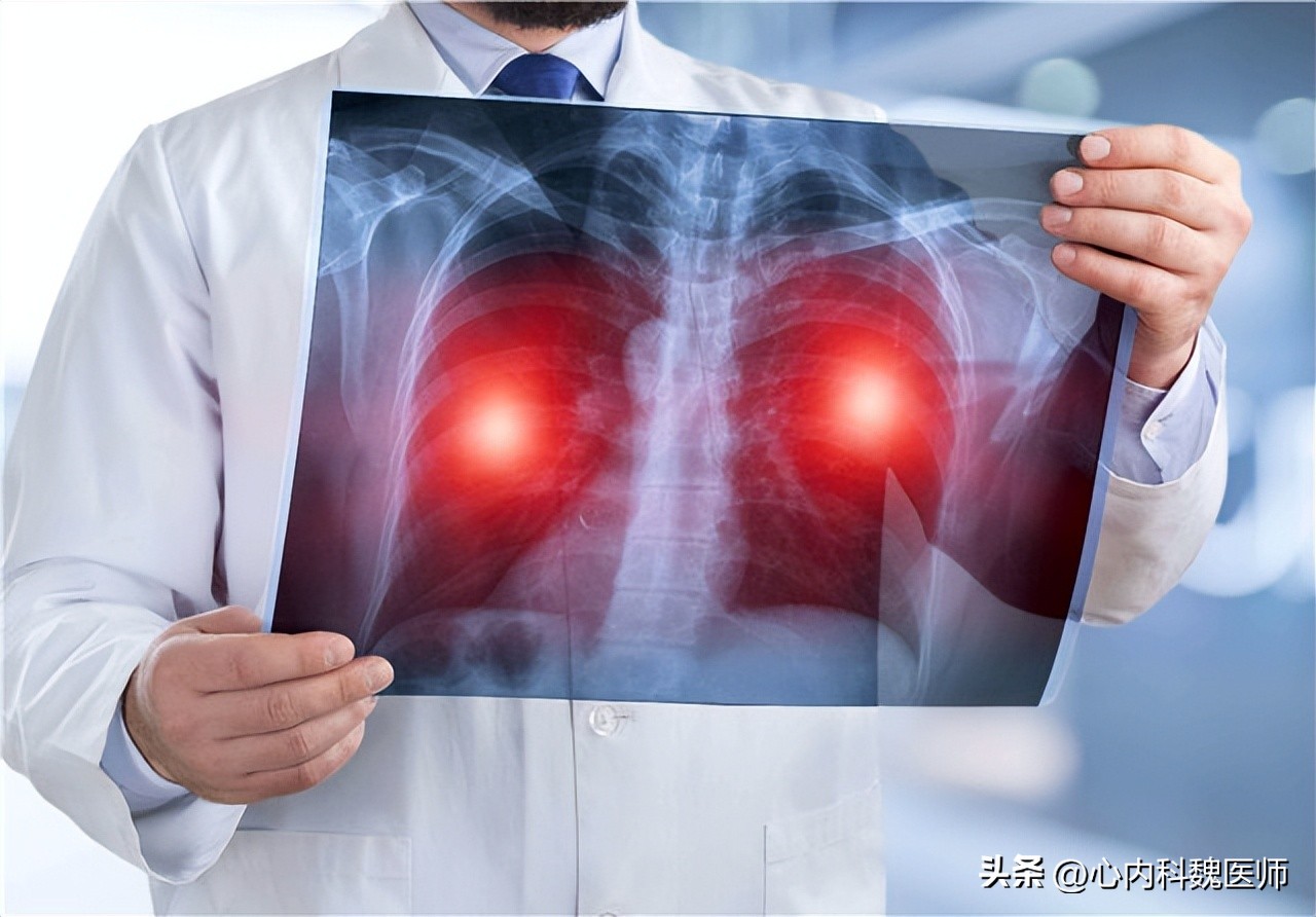 45岁男子吃3年恩替卡韦，却肝硬化了！医生：乙肝患者要注意3件事