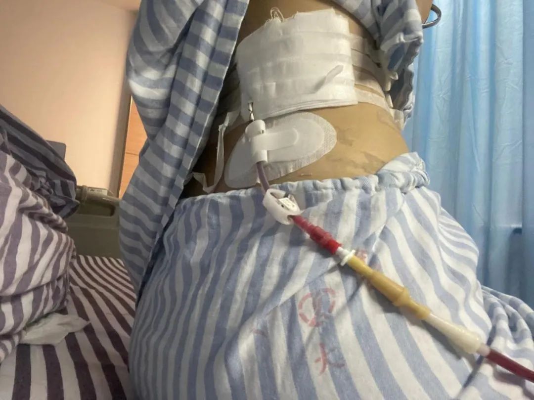 22岁护士实习,为安慰病人医生自述自己患癌