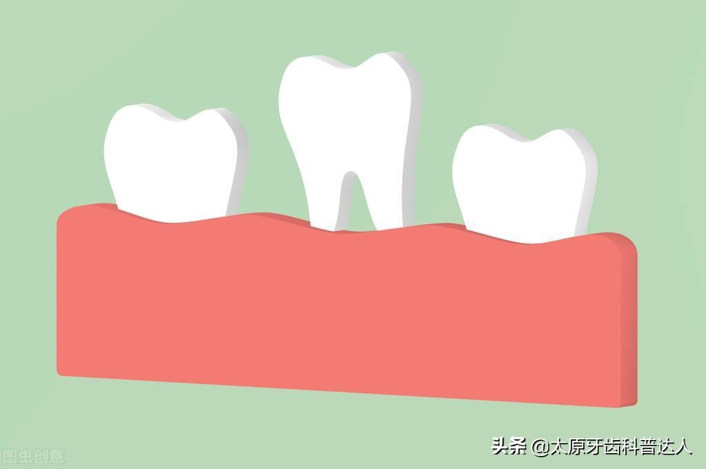 睡觉醒来牙齿松动是什么原因,牙疼牙齿松动又痛是什么原因