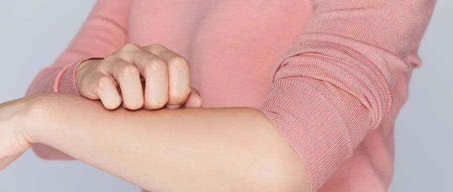 狼疮起皮疹了什么原因,狼疮患者平时皮肤会很差吗