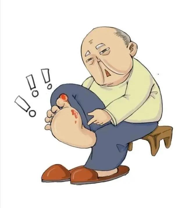 怎样治疗糖尿病足部溃疡,糖尿病人足部溃烂怎么办