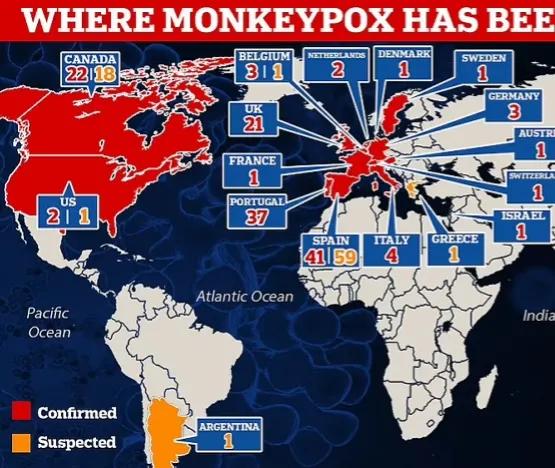 全球确诊38例猴痘病例,美国猴痘确诊病例数居全球首位