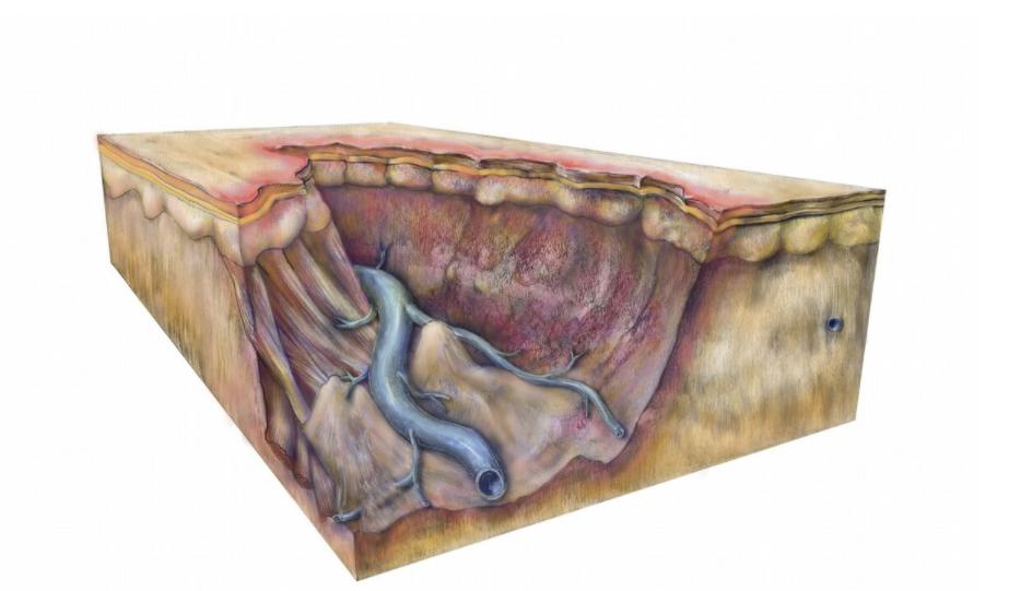 结痂的伤口，痒到怀疑人生，到底该怎么对待？看看医生怎么说
