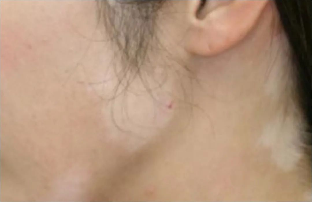 这些牌子护肤品别用小心烂脸,这些使用护肤品误区一定要避开