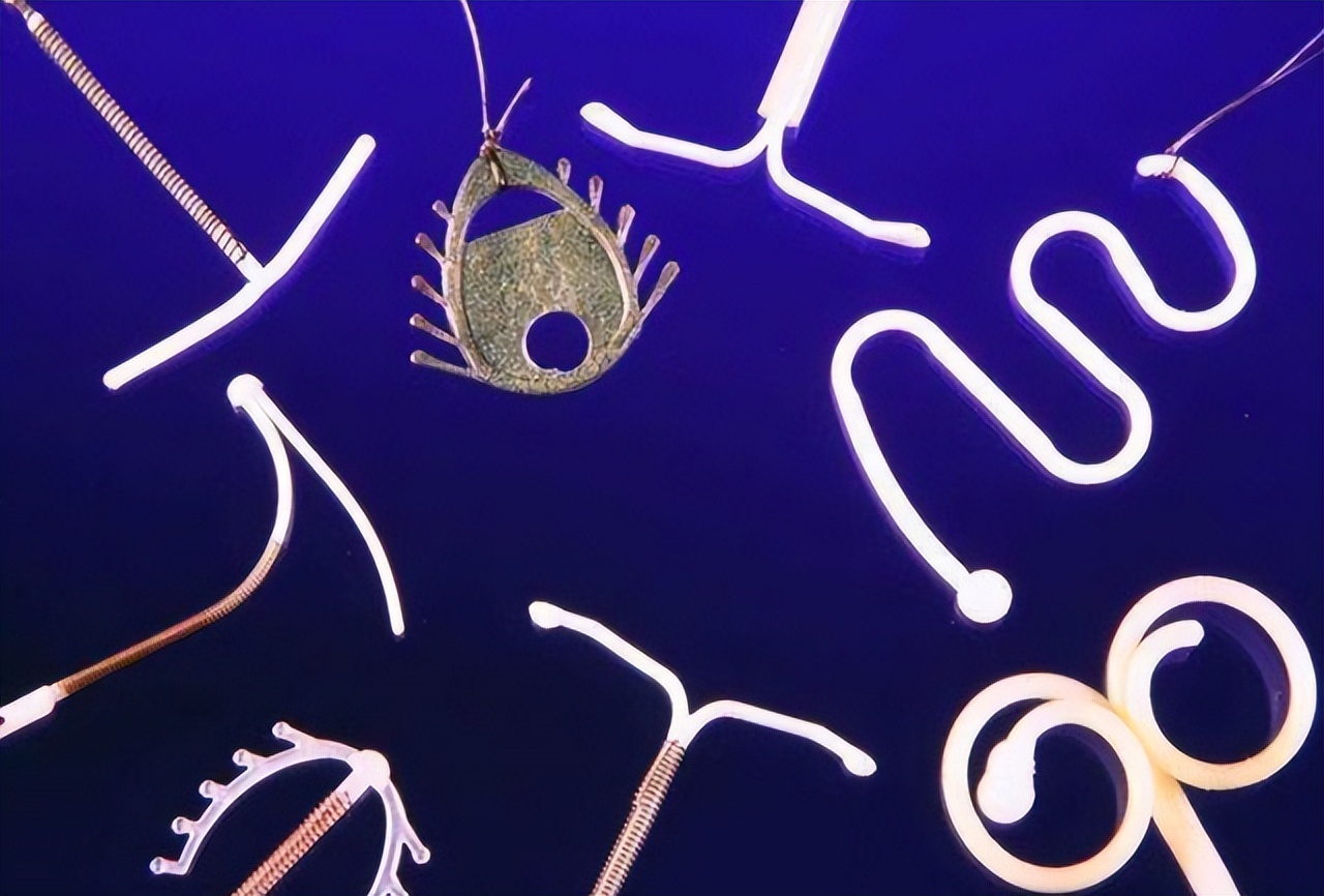 节育环不绝经可以取吗,节育环不取出来会经常肚子疼吗