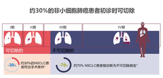 肺结节门诊与胸外科门诊区别,肺结节专科门诊是什么科