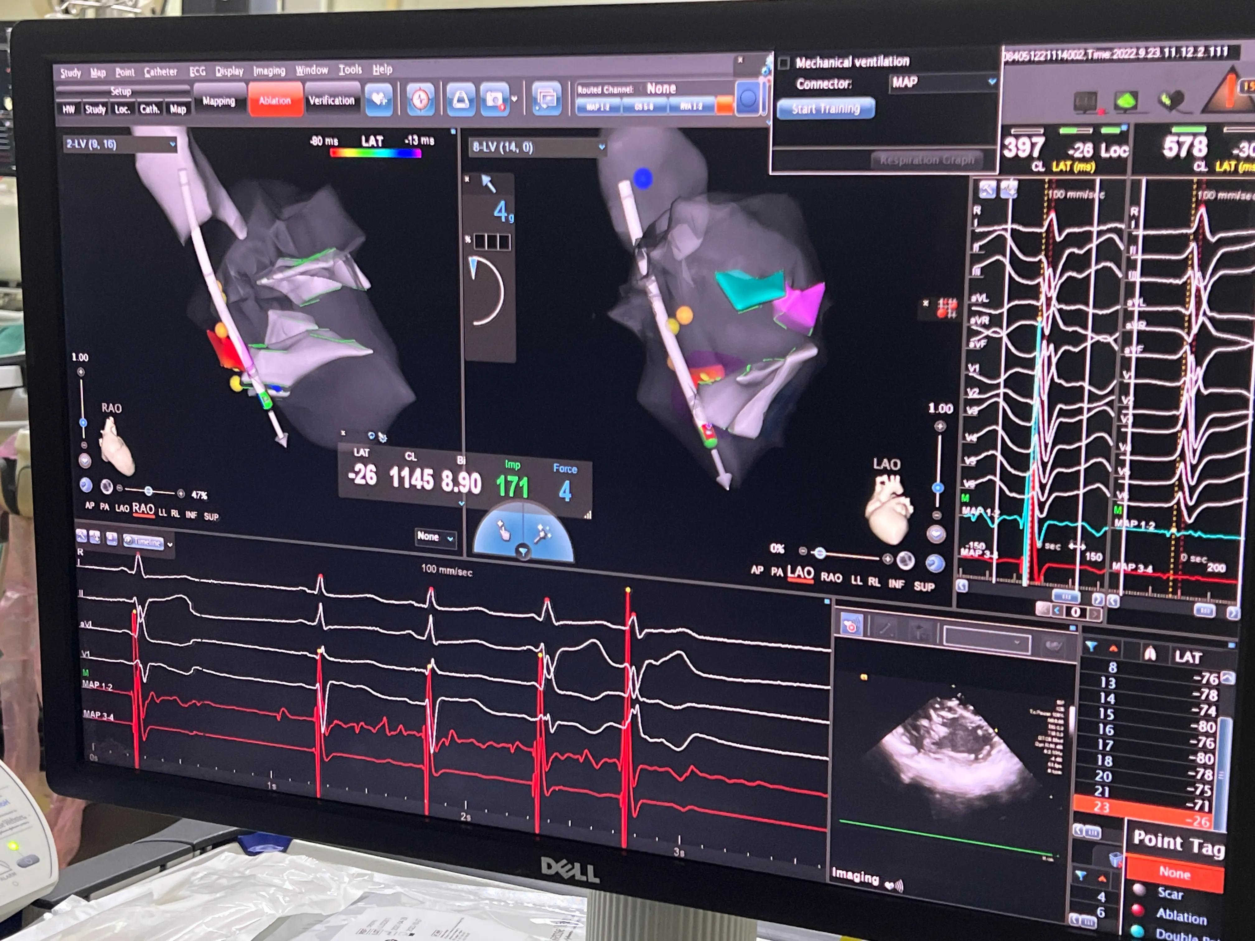 胸闷气促病例分析,小孩胸闷气短去检查说有炎症