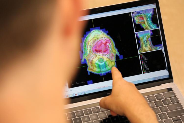 恶性肿瘤患者放疗期间吃点什么好,恶性肿瘤放疗后的注意事项