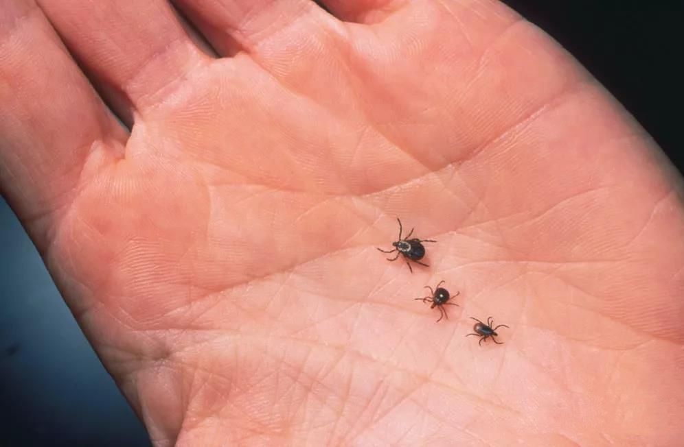 被蜱虫咬后死亡的几率有多大,夺命蜱虫怎么去除