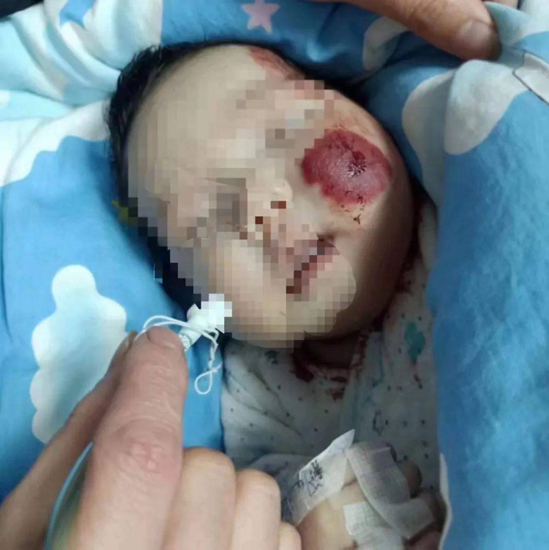 抢救新生儿接力,争分夺秒抢救新生儿