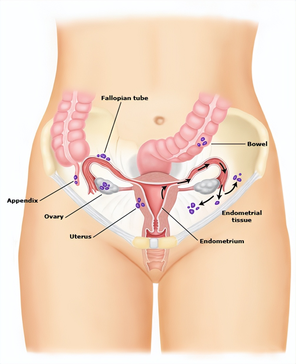 每次月经期都会咯血如何治疗,月经咯血怎么治病