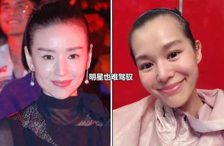 头发的长短稀疏决定衰老的速度,头发稀少又白让人一下子老了几岁