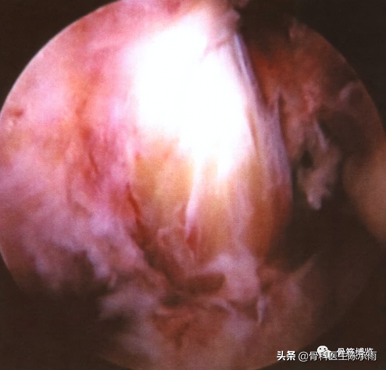 膝关节2度损伤需要做关节镜吗,膝关节常见损伤的检查方法