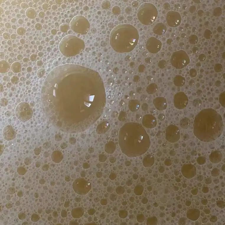 白带呈水样有血丝有腥臭味,孕18周有脓性白带带血丝