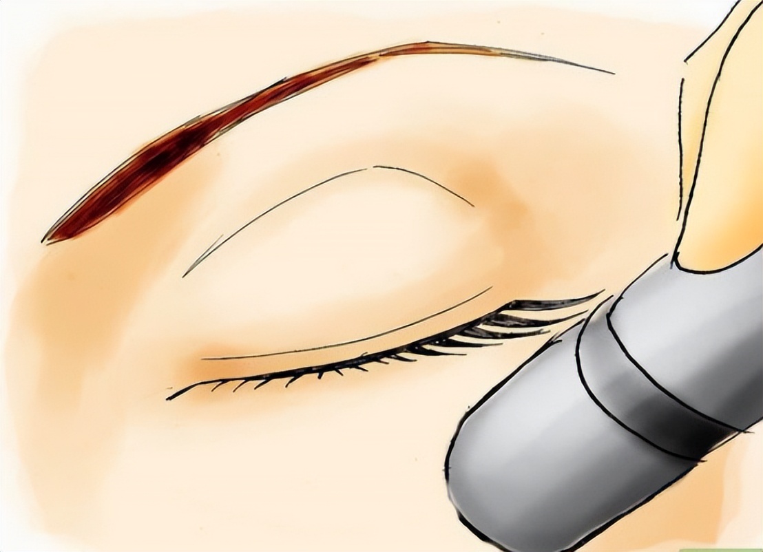 烧伤患者创面处理,烧伤创面处理的原则主要是