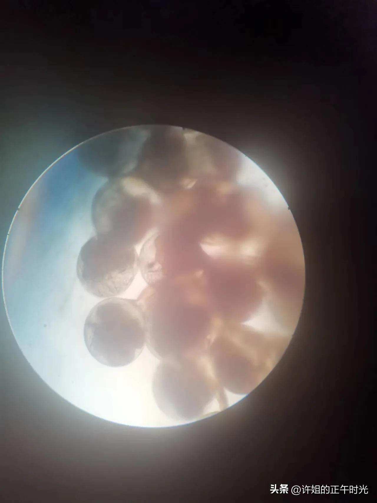 螃蟹生长中需要vc吗,螃蟹的生长过程动画版