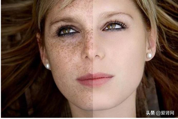 皮肤越变越黑,皮肤黑的暗淡无光怎么办