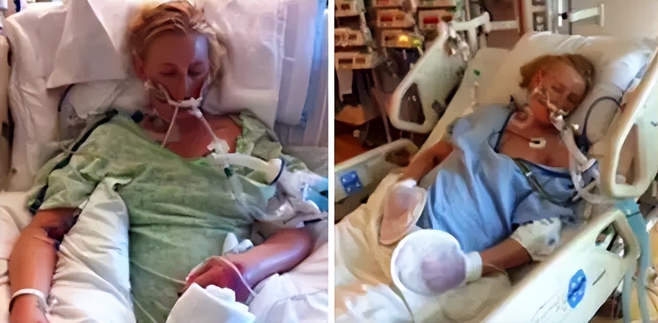 超模用卫生棉条感染截肢励志,一名超模因卫生棉截肢