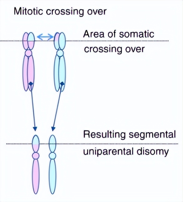 试管婴儿pgt-a检测结果怎么看,试管婴儿不孕不育基因检测