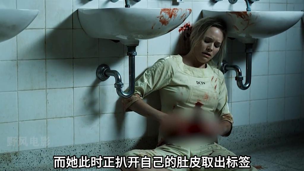 女人重新拆开缝线，只因医生故意放进一个塑料标签#惊悚悬疑