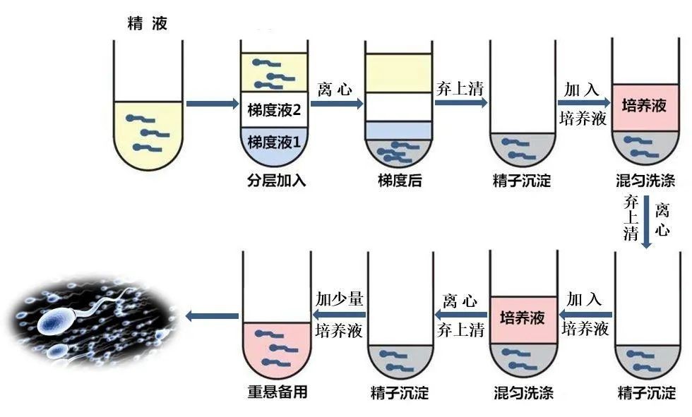 试管婴儿常识100例,试管精子是怎么优化处理的