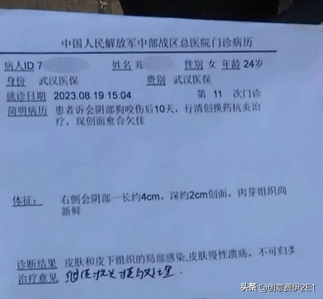 女生夜跑被恶犬咬伤后续,女子夜跑被恶犬咬伤在哪个部位