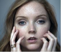 玛恩医生|激光祛雀斑后的护肤如何做？