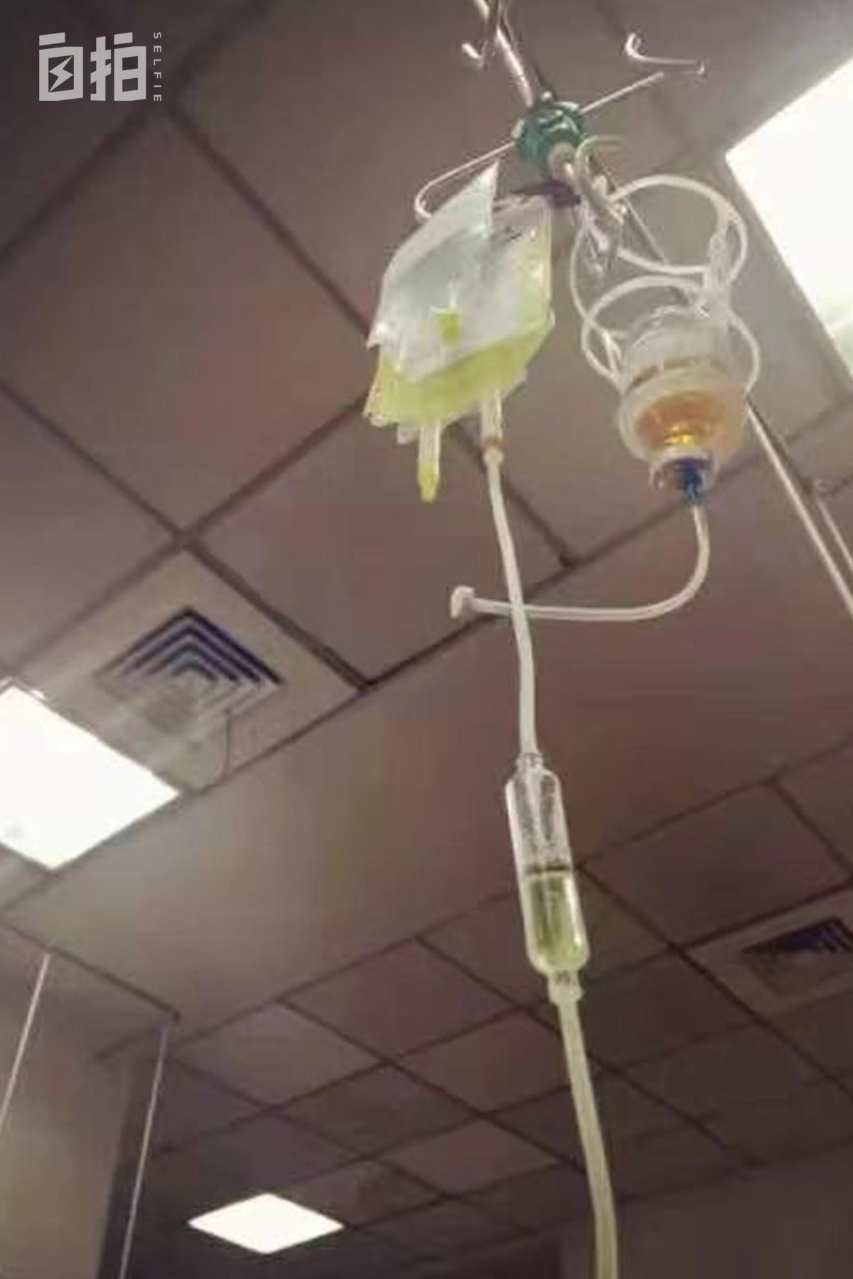 鍏堝ぉ鎬уけ鑱墜鏈垂澶氬皯,澶辫仾鎵嬫湳鎭㈠鍚姏