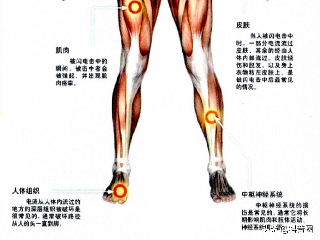 闪电的威力到底有多大劈到人,闪电的可怕威力