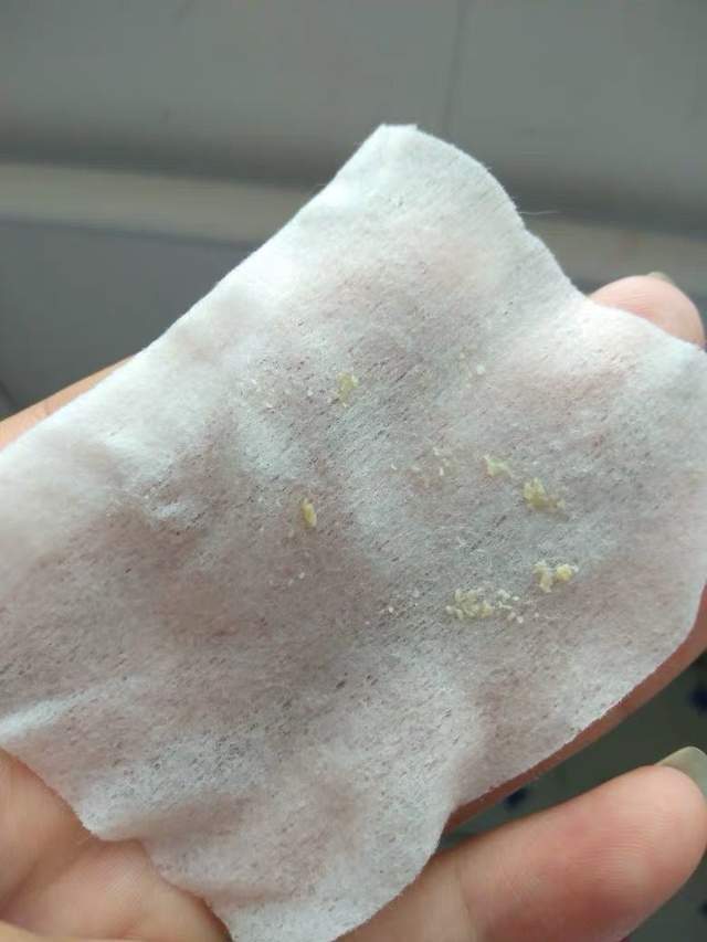 清洁面膜可以去黑头粉刺闭口吗,清洁面膜可以去除黑头吗