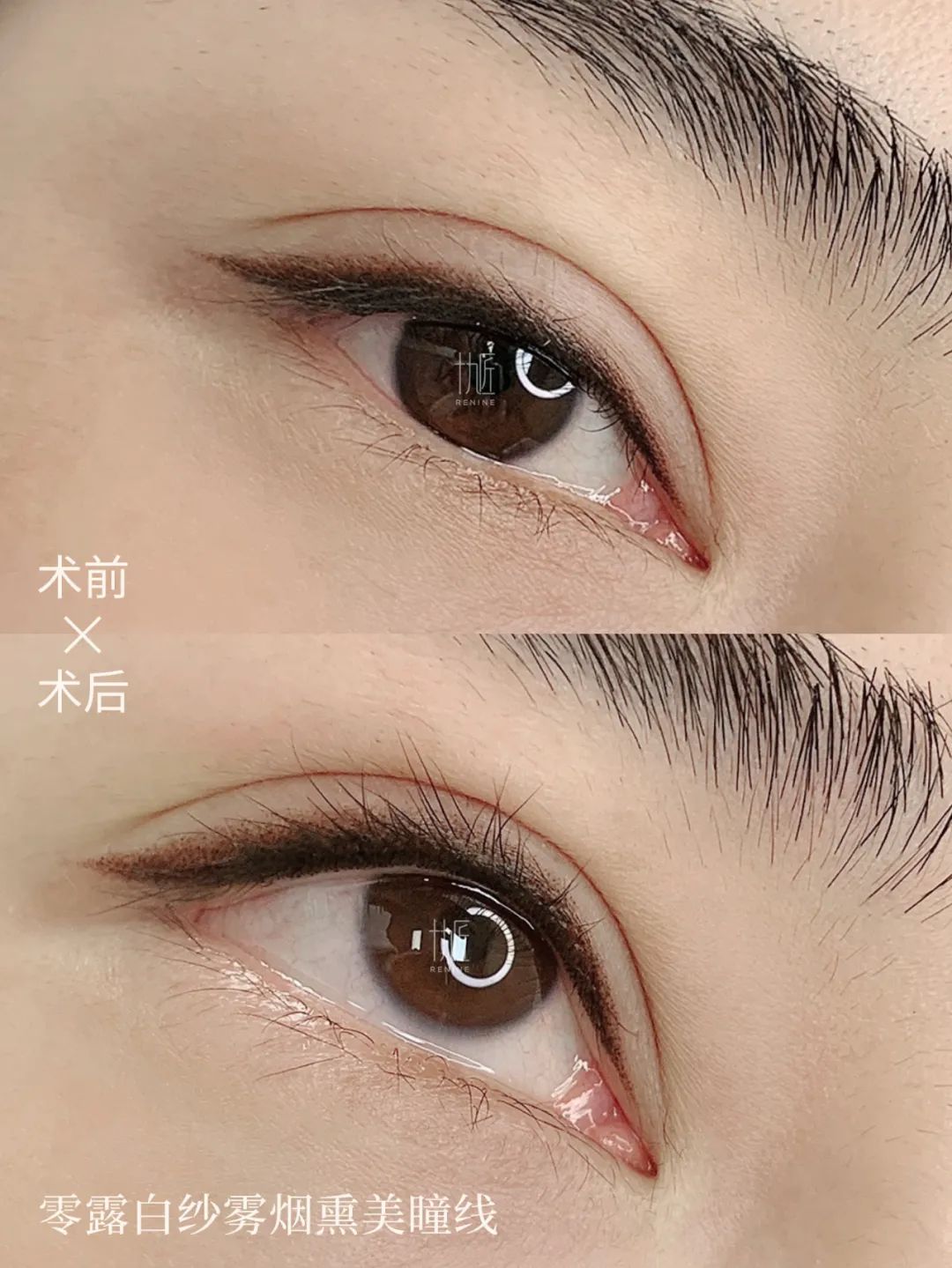 美瞳戴起来不痛吗,做美瞳线用什么舒缓乳不痛