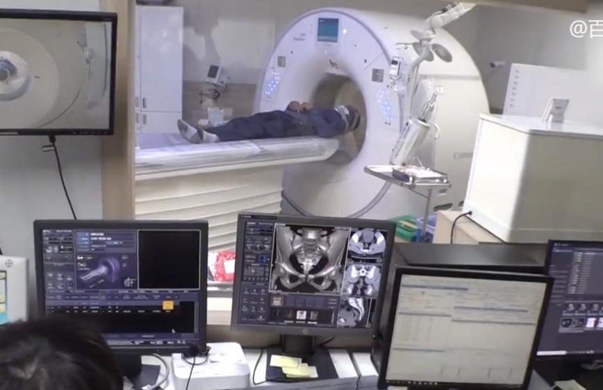 韩国大爷脑袋里有蜘蛛后续,72岁大叔脑里有蜘蛛