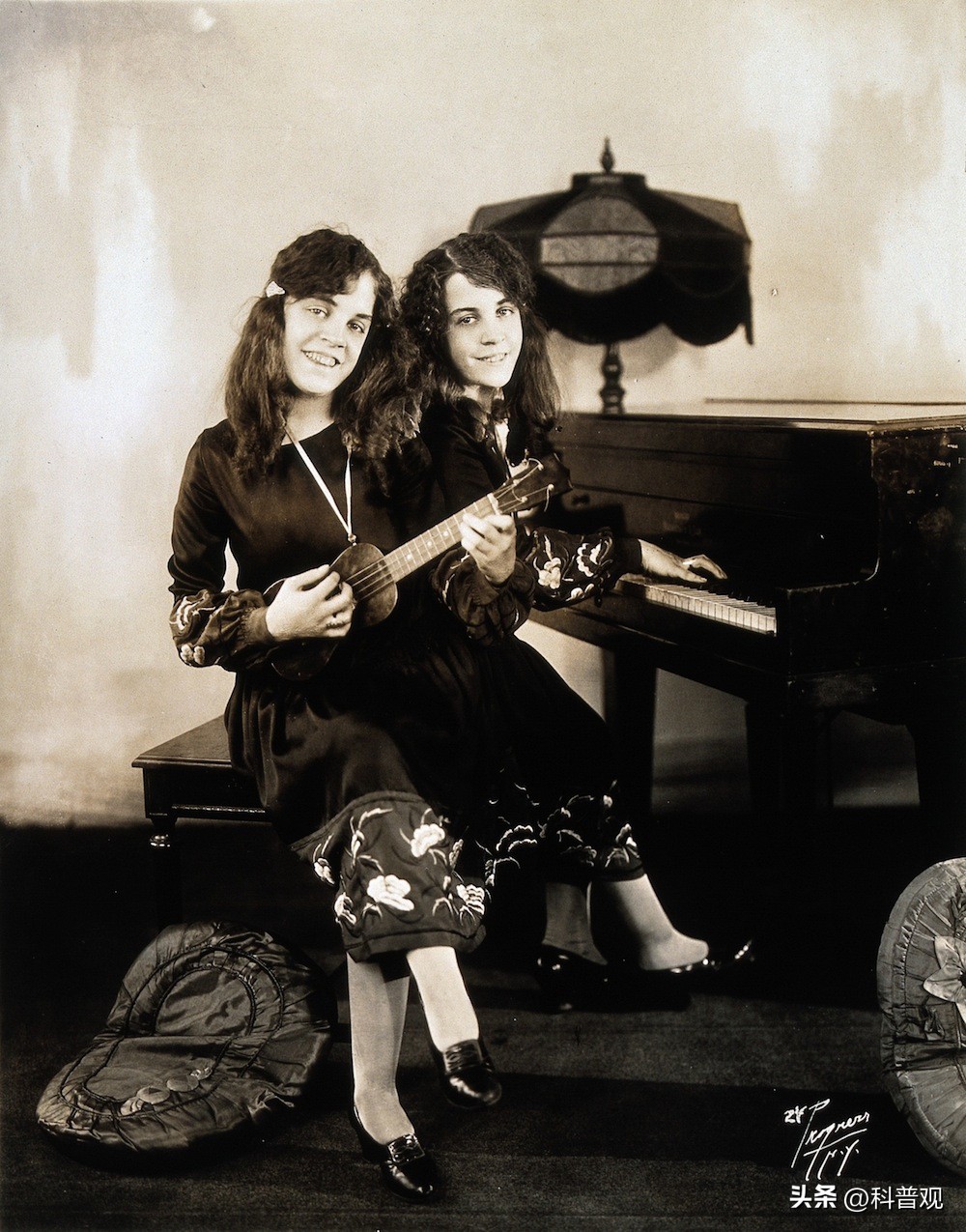 连体人一人去世了另一人会死吗,连体人死亡对另一半有影响吗