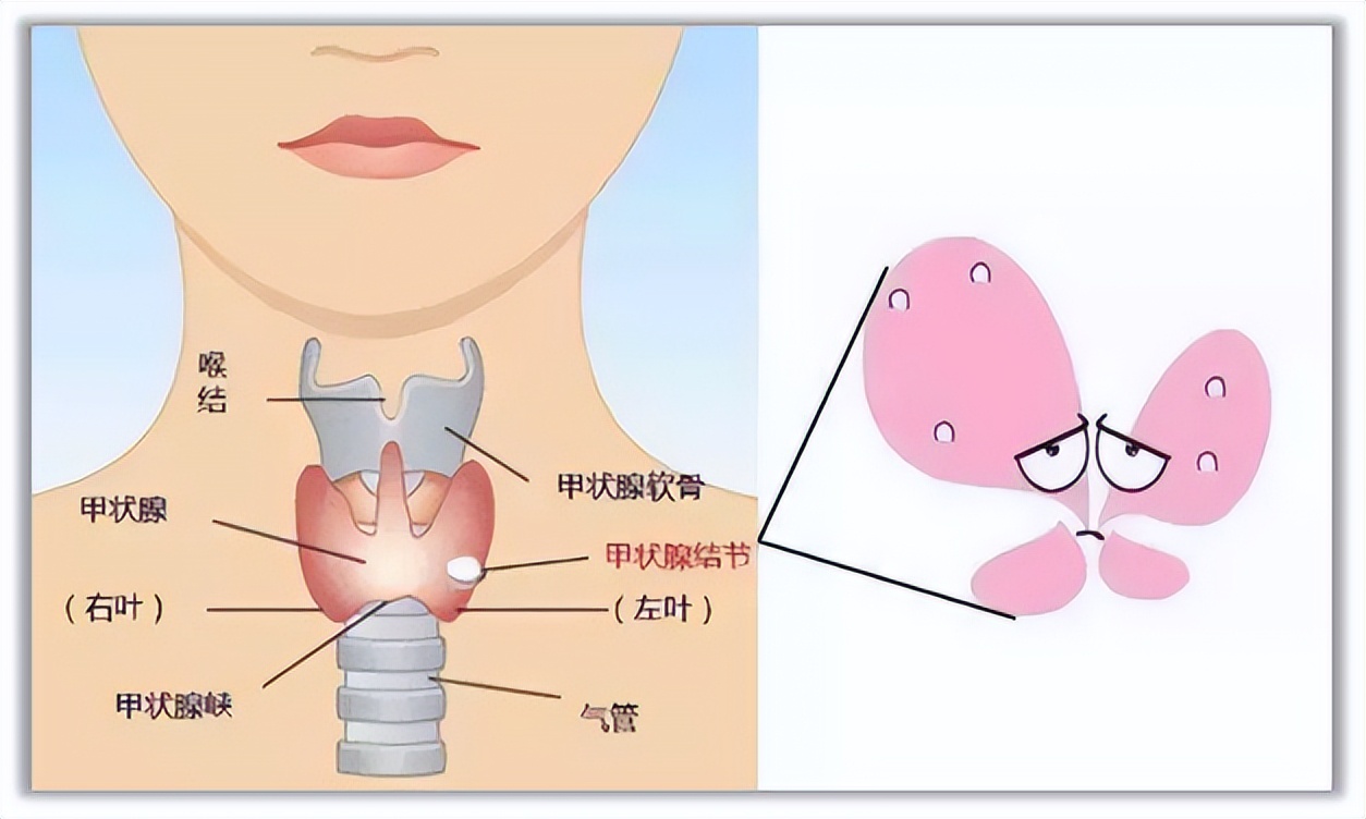 世界甲状腺知识宣传周宣传视频,世界卫生组织甲状腺结节