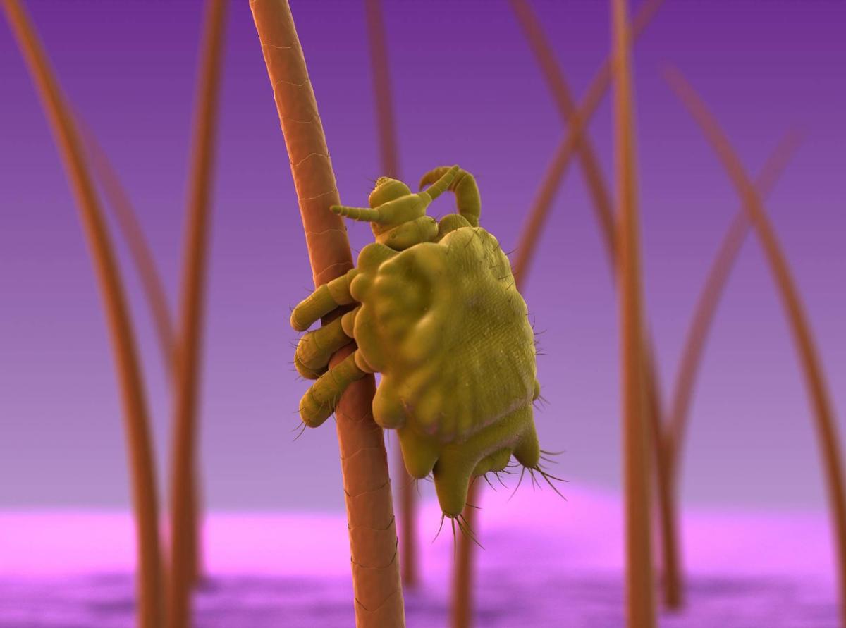 女子腹部痒，医生用镊子夹出16只阴虱！原来阴虱有4个传播途径