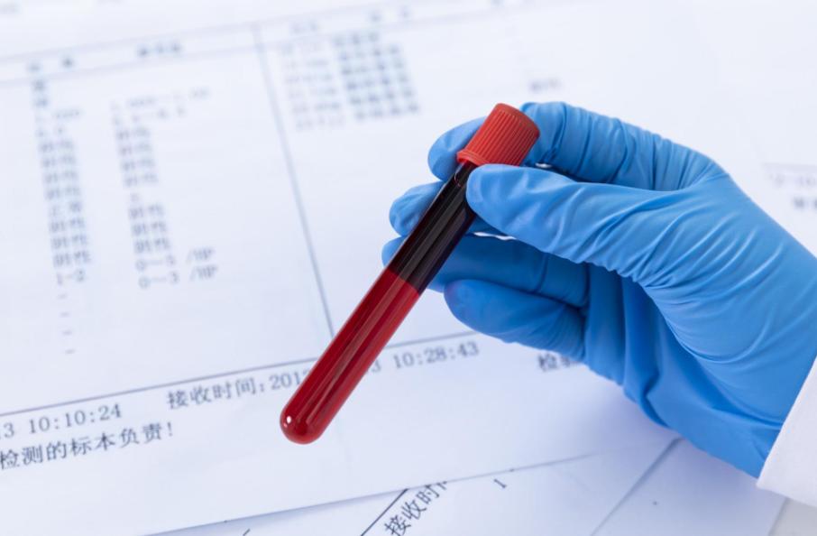 血常规中嗜酸性粒细胞升高要警惕,血热做血常规什么指标会升高