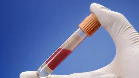 血制品提价最新消息,血制品供不应求提价预期强烈