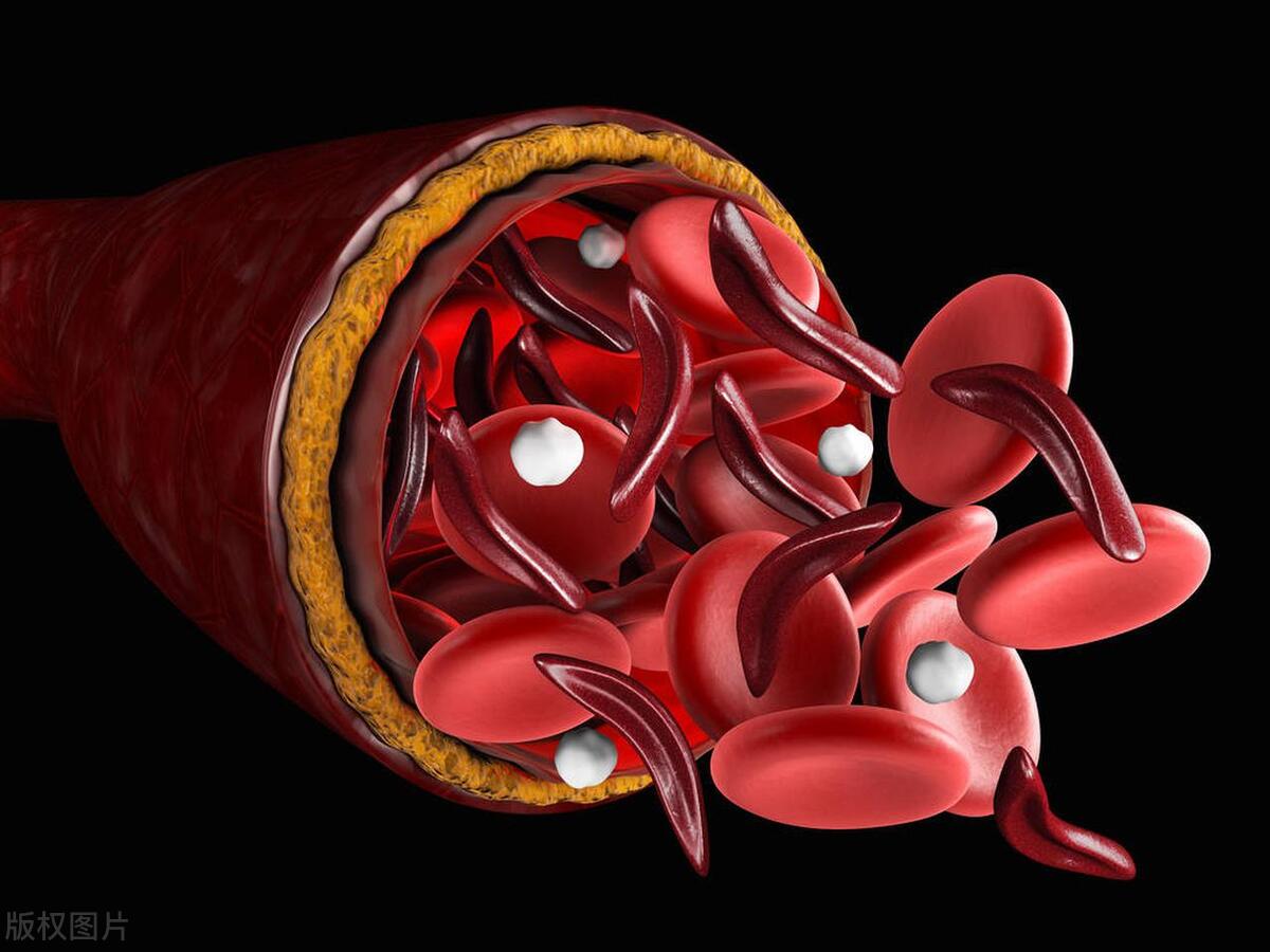 女性绝经后还轻微出血,女性绝经了发现出血