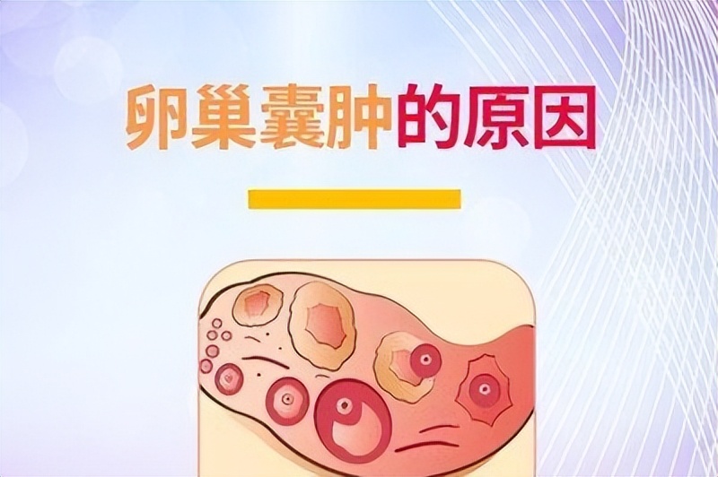 如果囊肿出现在3个地方要警惕,刚发现的囊肿怎么治疗