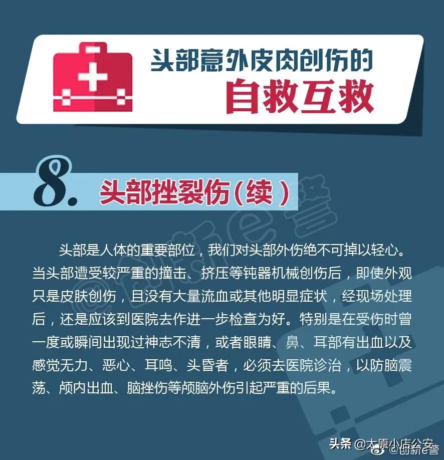头部意外创伤,头部意外创伤如何自救