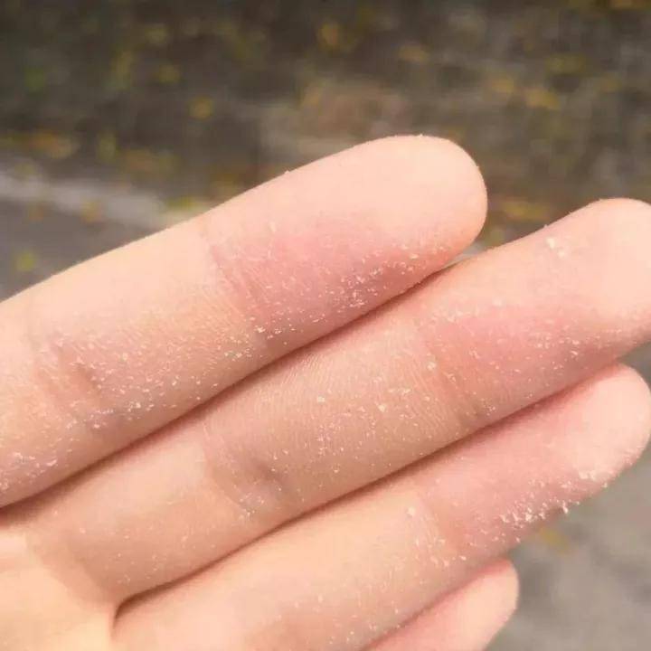 狐臭止汗露推荐不显黑,狐臭止汗露推荐真实测评怎么用