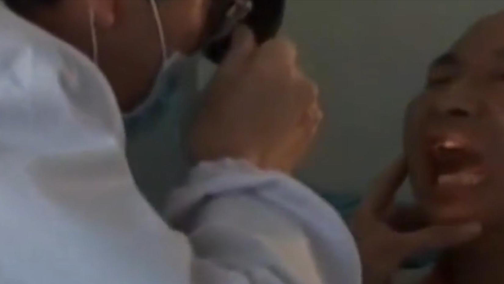 云南男子口臭手术后现在怎么样了,云南男子口臭查出了大毛病