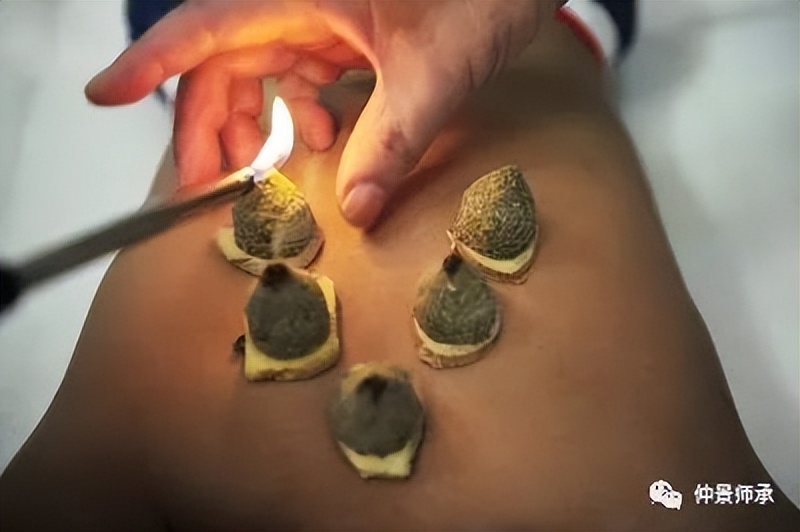 宫寒痛经，从表证论治经验分享