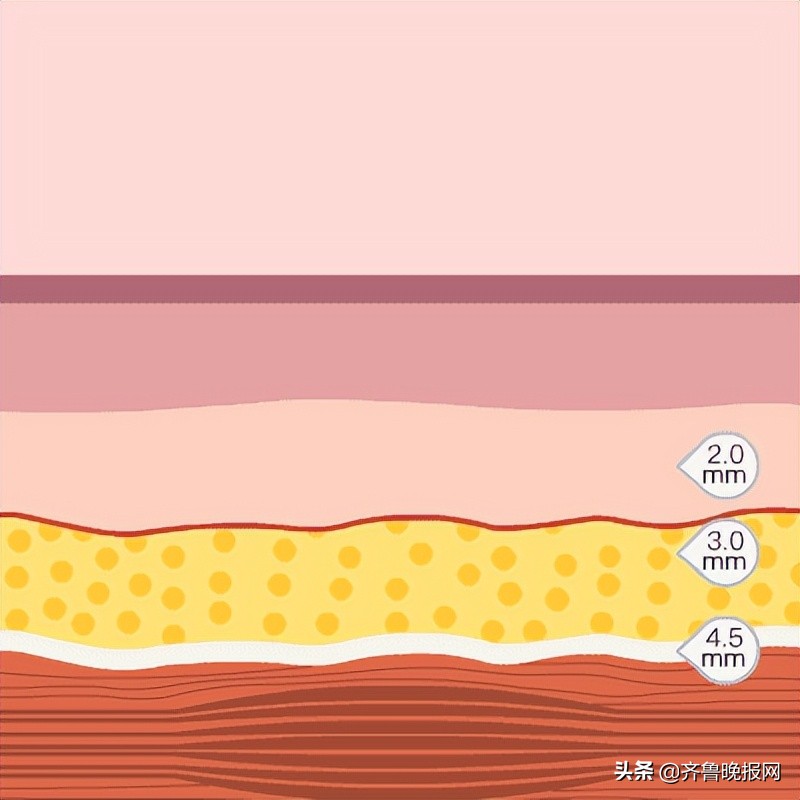 半岛超声炮抗衰新宠体验价980元,半岛超声炮云南