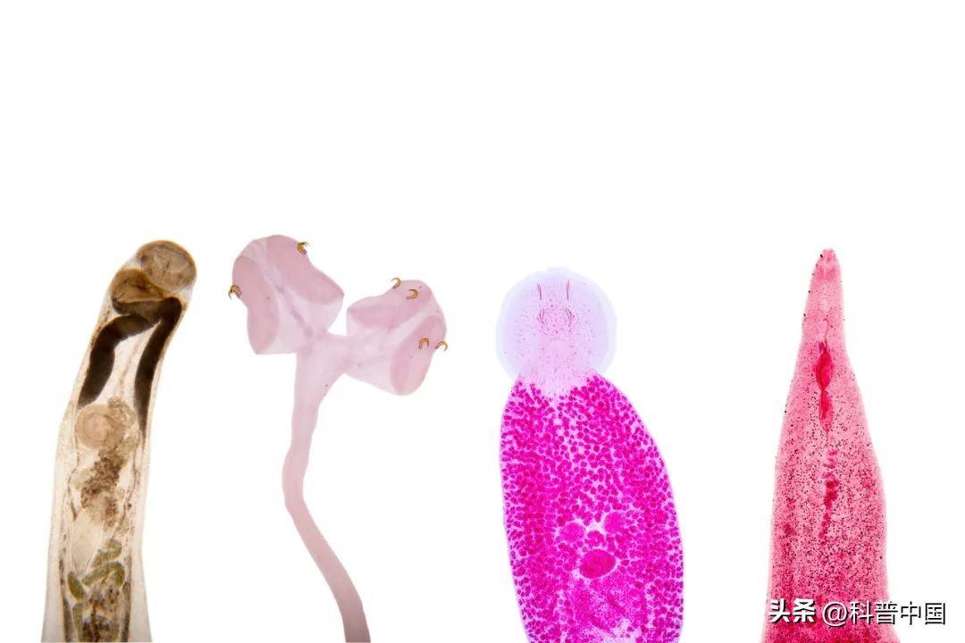 怎样除去生吃蔬菜寄生虫,这5种蔬菜别生吃小心感染寄生虫