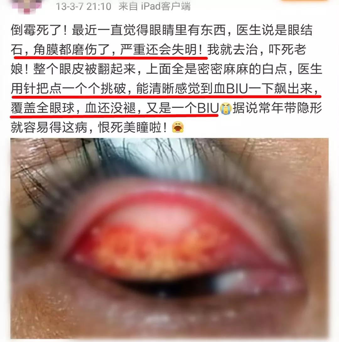 你戴美瞳多久了,你还在戴传统面罩吗